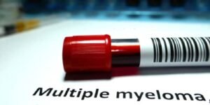 Read more about the article DIAGNOSIS & EVALUATION OF MULTIPLE MYELOMA